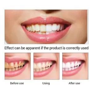 Original Teeth Whitening