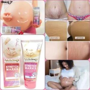 Fruit Of The Wokali Stretch Marks Remover Cream, 130ML