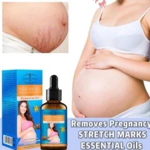 Strech mark removing oil the snail oil