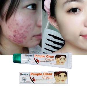 Himalaya herbals acne pimple cream 20g