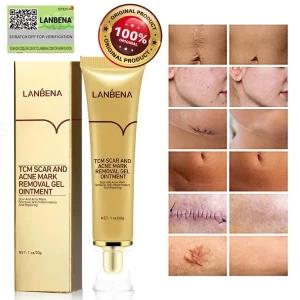 Lanbena TCM Scar & Acne Mark Removal Ointment Gel 150g