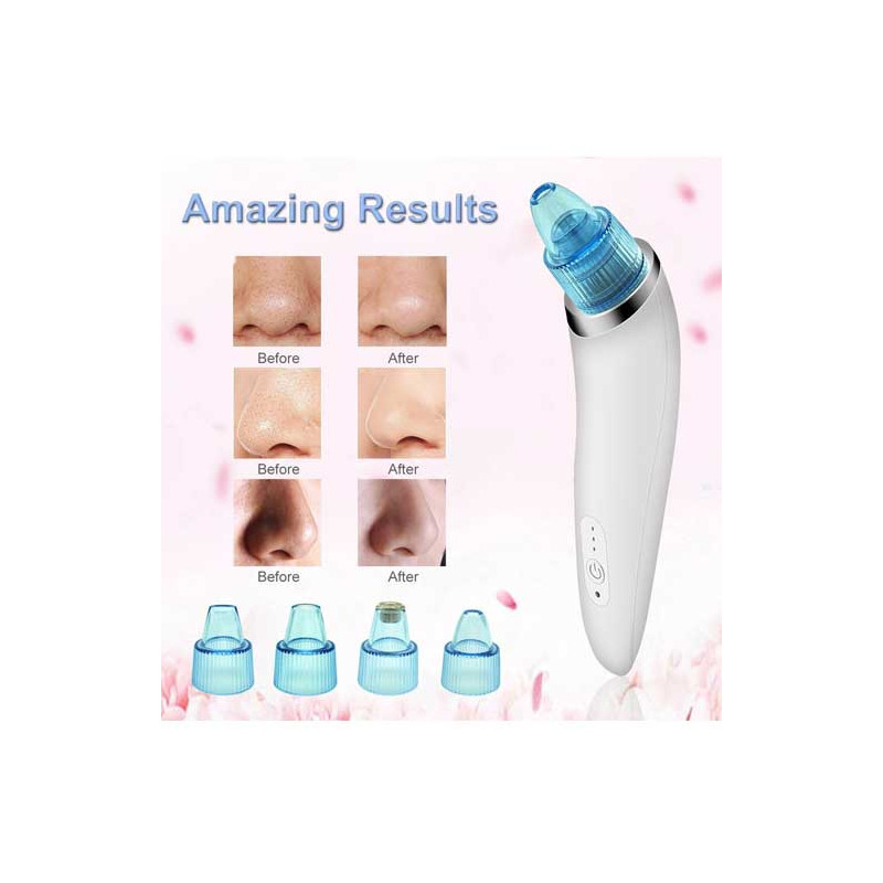Electric Facial Pore Cleaner/Acne Remover